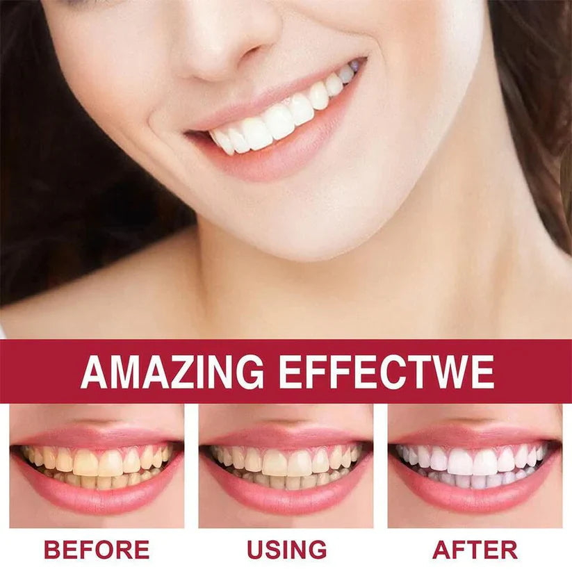 Teeth Whitening Foam Wash